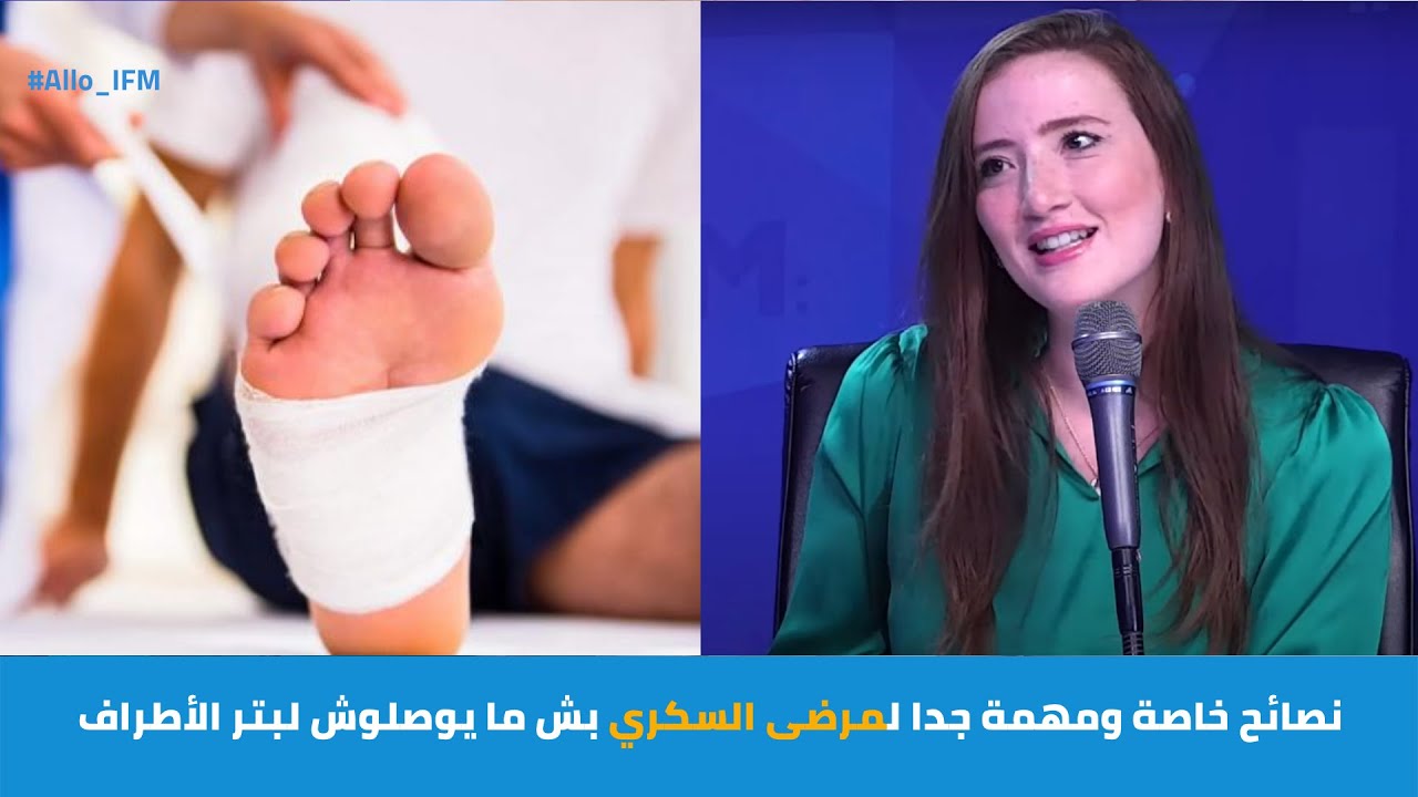 نصائح خاصة ومهمة جدا لمرضى السكري بش ما يوصلوش لبتر الأطراف