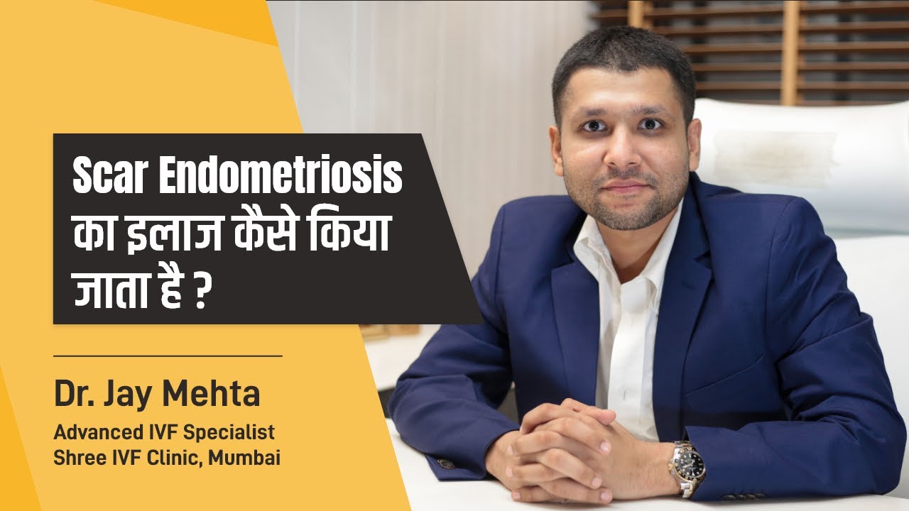 Scar Endometriosis का इलाज कैसे किया जाता है ? | Treatment of Scar Endometriosis | Dr. Jay Mehta