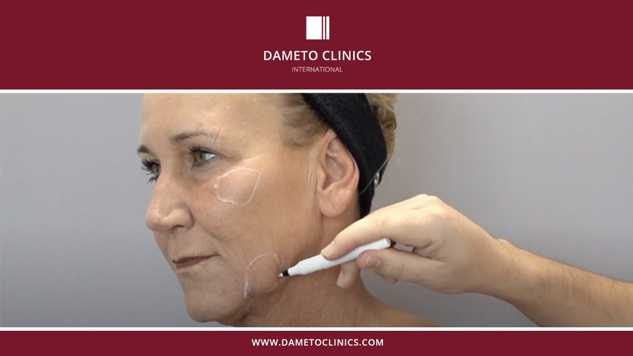 Cellbooster Shape by Dr. Gabriel Siquier