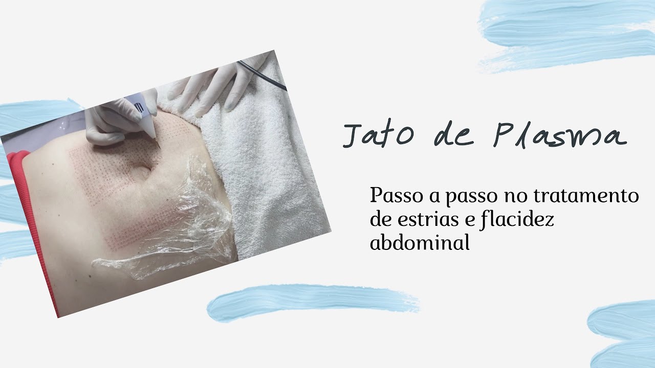 Você sabe como é feito Jato de Plasma para Flacidez e Estrias Abdominais?