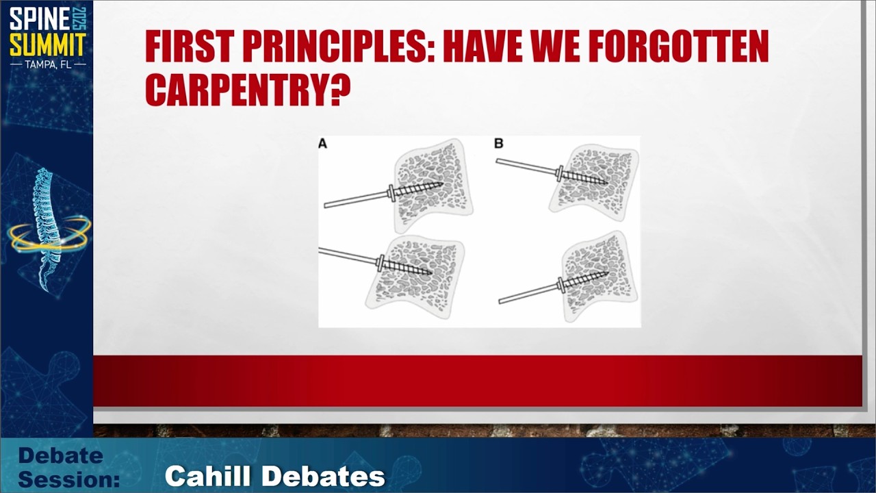 DSPN Spine Summit 2025 | Day 2 | 2 22 25 | Dr. Dan Resnick | Cahill Debate: 3D Cages v PEEK