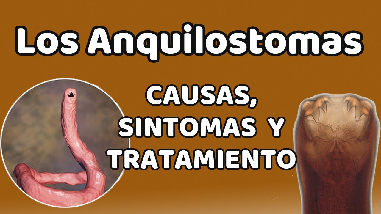 LOS ANQUILOSTOMAS, Causas, signos y síntomas, diagnóstico y tratamiento