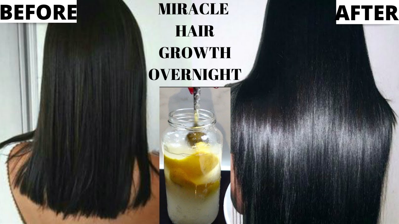 HAIR GROWTH SECRET | How To Grow Longer Thicker Hair Naturally & Fast | CURE HAIR LOSS [DIY REMEDY]