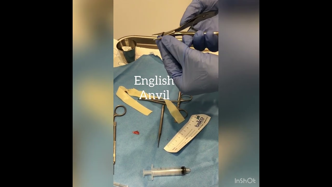 Dr. K discusses ingrown toenail removal and tools of the trade for the procedure.