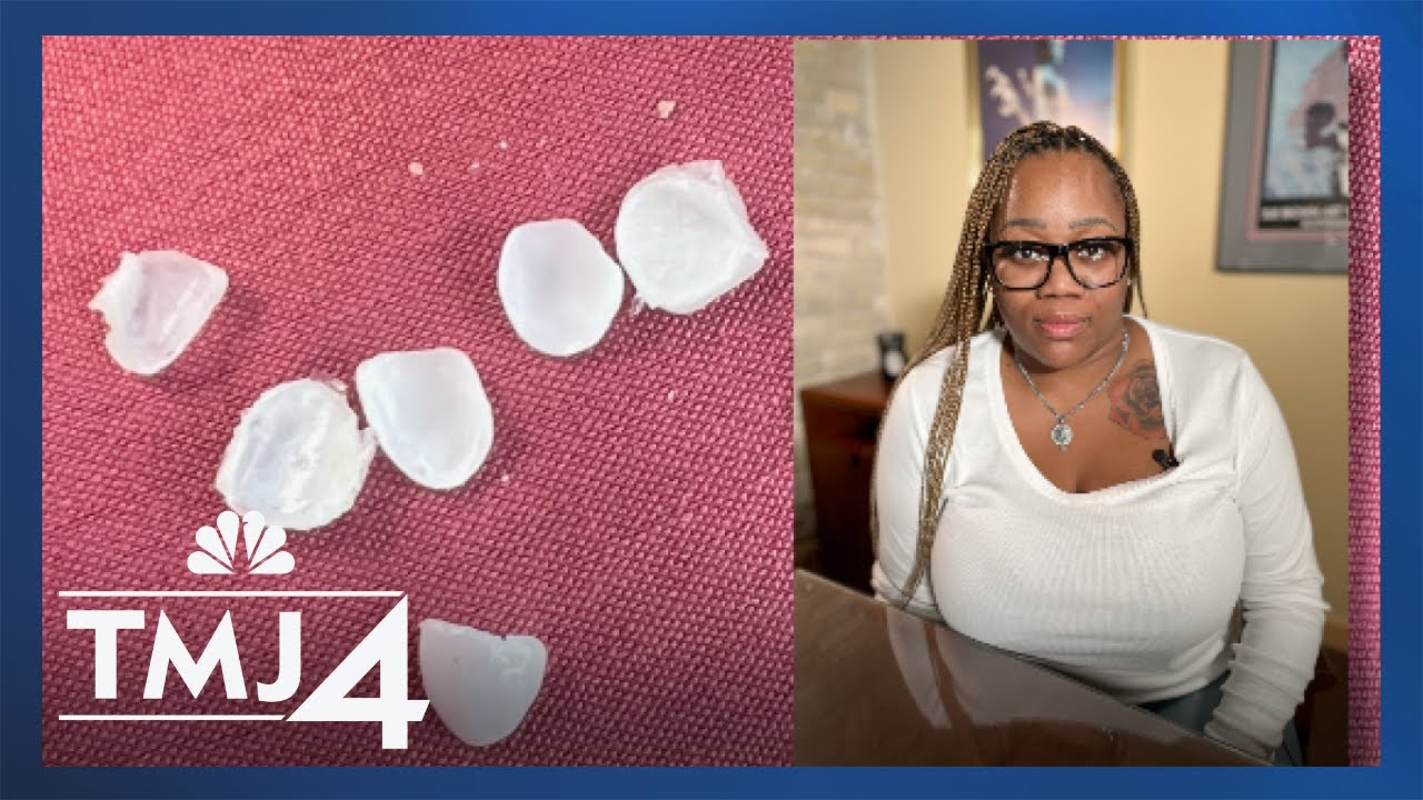 Woman sues unlicensed ‘fake dentist’ in Milwaukee after veneers ruin her teeth