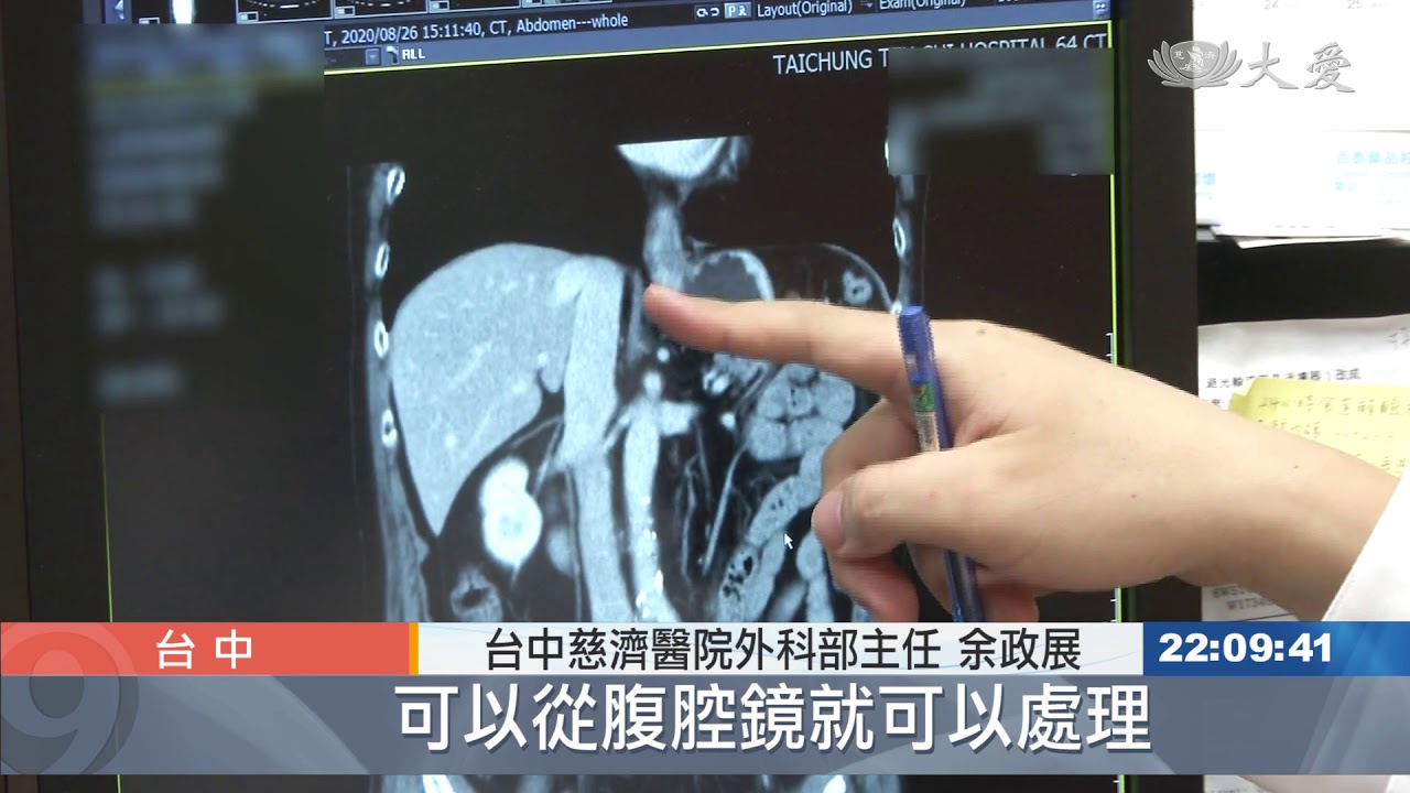 關於胃癌存活率... 台中慈院交成績單
