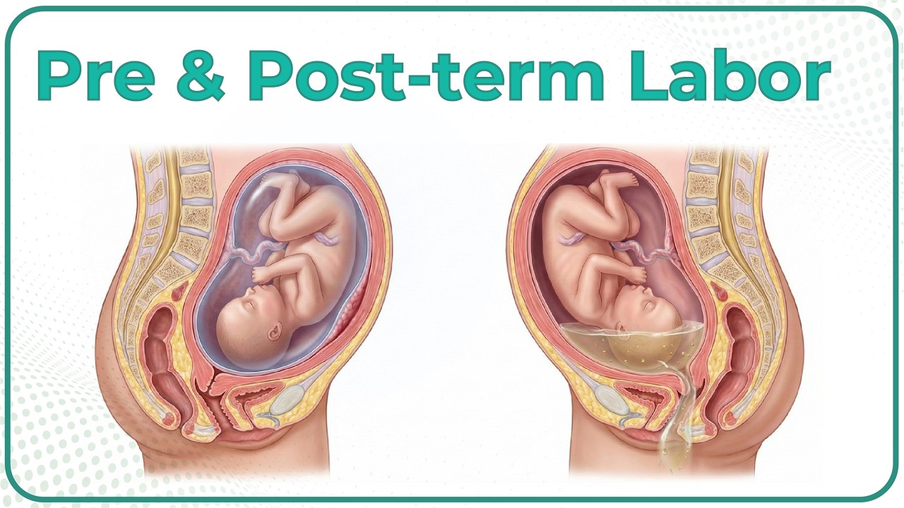 Preterm Labor and Preterm Premature Rupture of Membranes (PPROM)