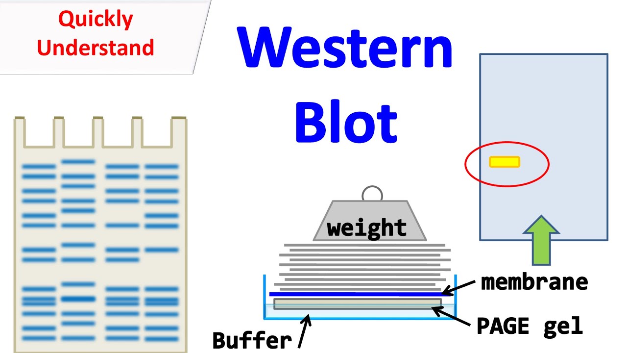 Western blot