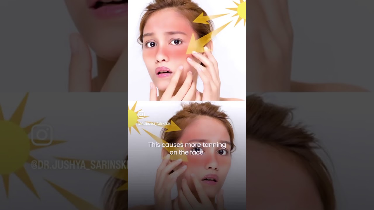 🌞 Do you ever notice that your face is darker than the rest of your body? 🤔 || Dr Jushya Sarin ||