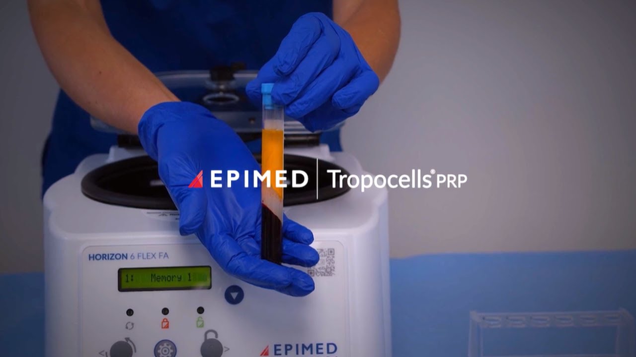 Revolutionary PRP System by EPIMED: Simple, Fast, and Effective for Pain Management