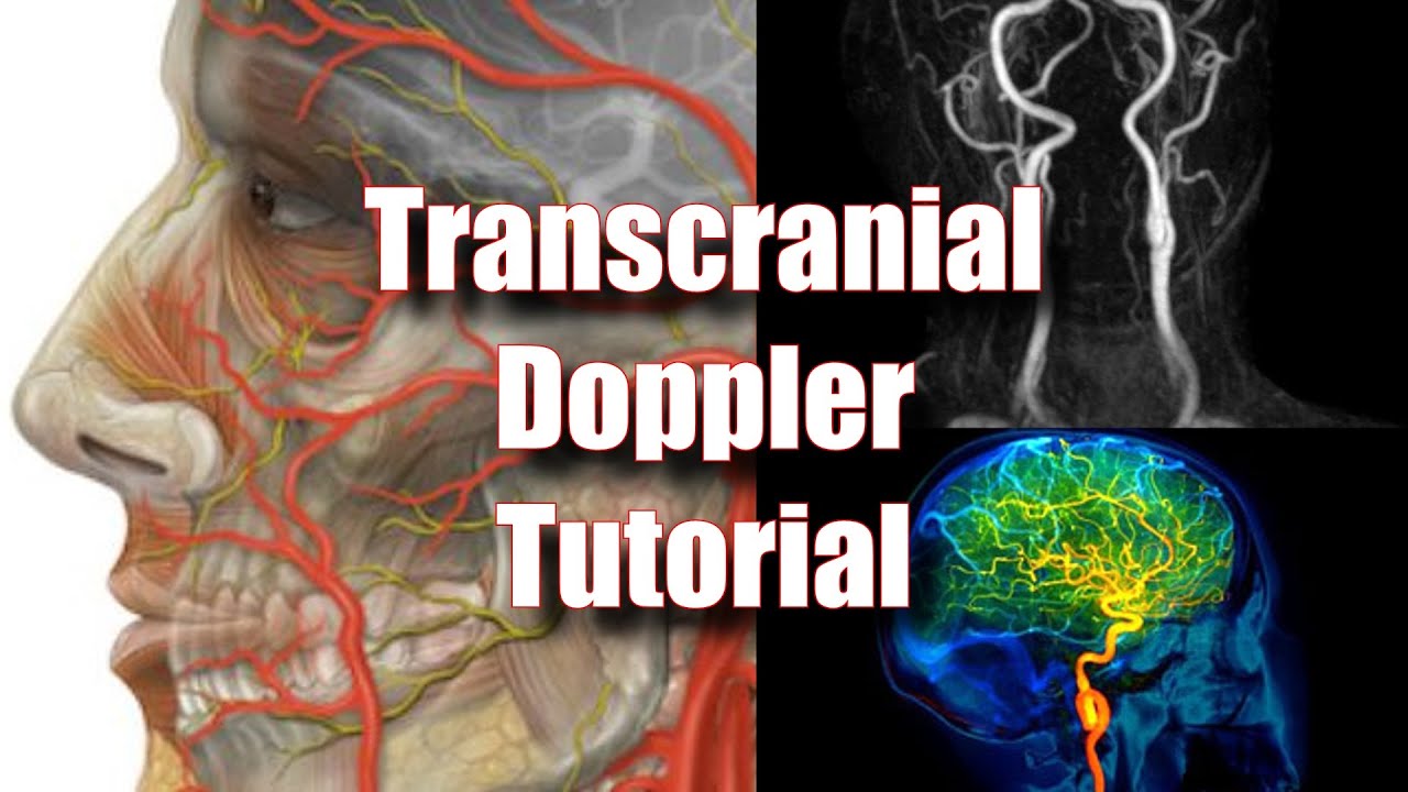 Transcranial Doppler: Tecnique, Anatomy & Protocol