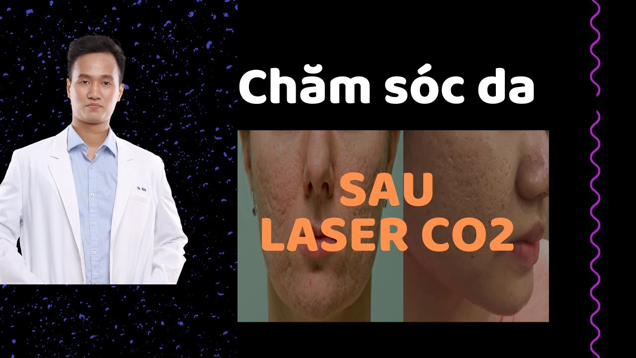 LASER CO2 - TRỊ SẸO - Hướng dẫn chăm sóc da ĐÚNG CÁCH sau Laser Co2 Fractional | Dr Hiếu