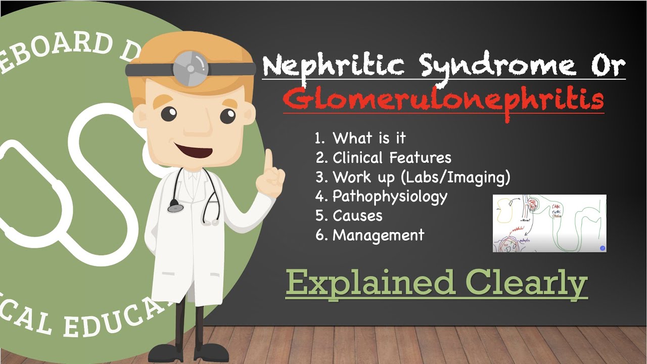 Nephritic Syndrome (Glomerulonephritis) - Clinical Features, Pathophysiology, Work Up, Causes, More!