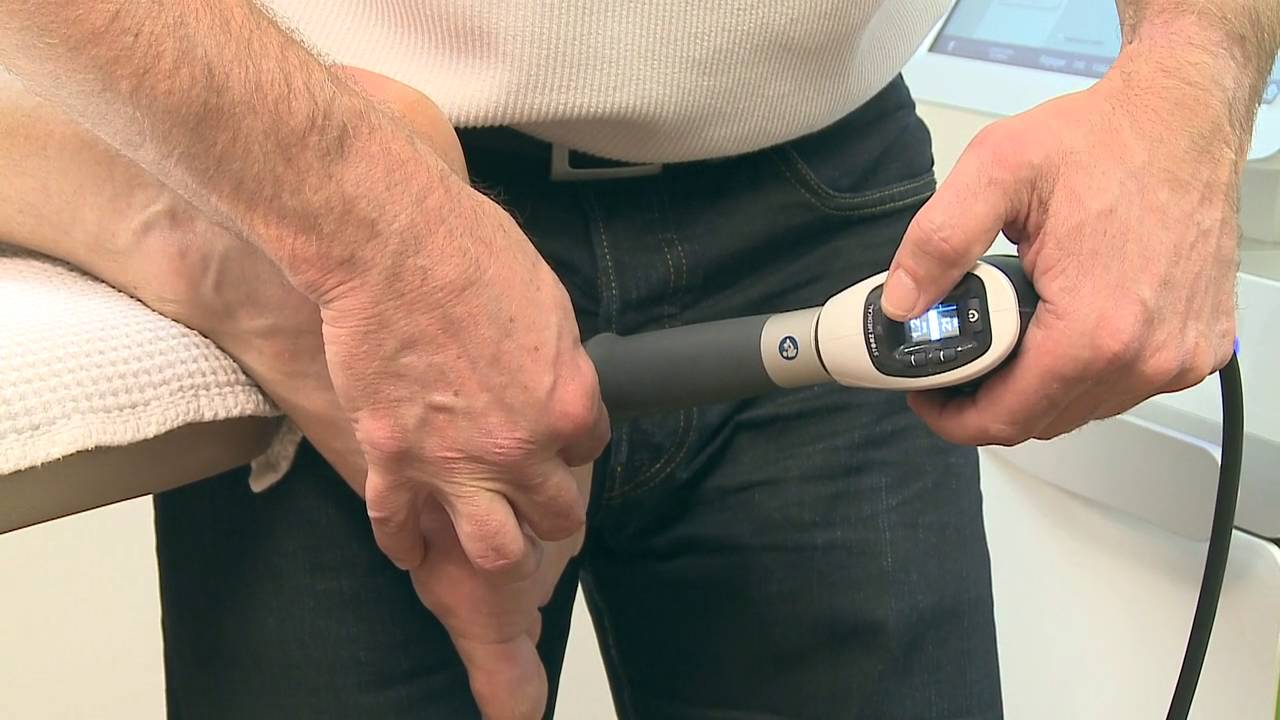 Qu'est ce qu'une épine calcanéenne? Comment guérir d'une douleur du pied: ondes de choc radiales