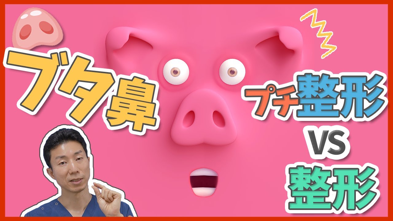 豚鼻を糸で治すプチ整形（ミスコ）と整形（耳介軟骨移植や鼻中隔延長）を比較解説【鼻整形】