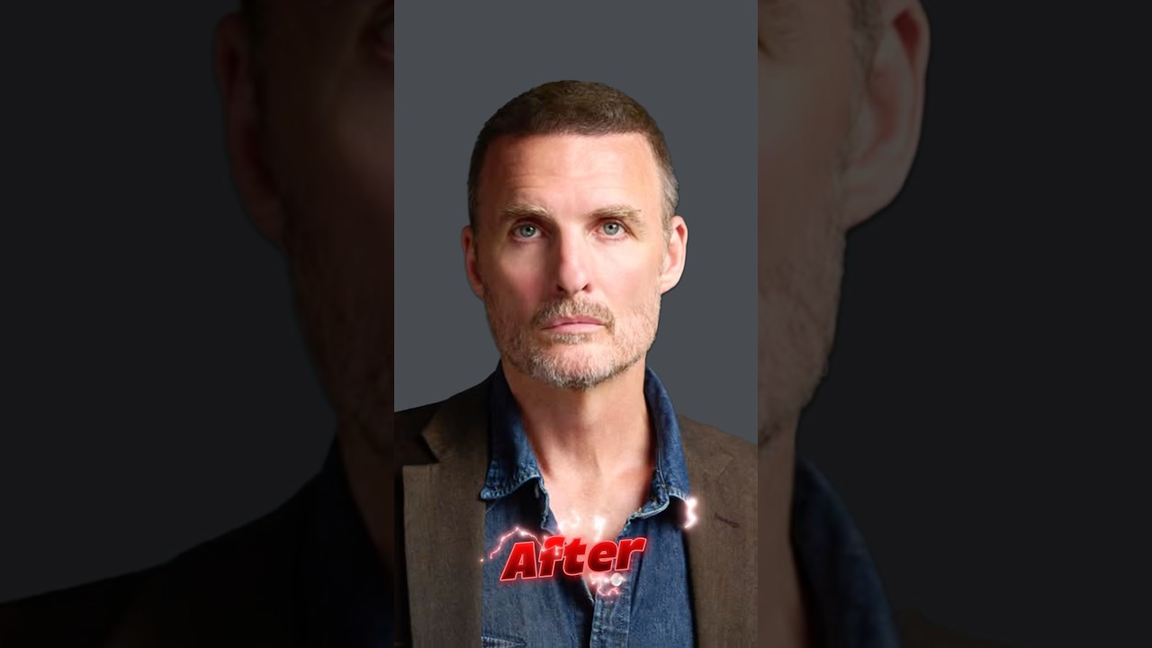 Greg Bryk's Hair Transplant Result #hairtransplantturkey #gregbryk #shortsvideo #shorts