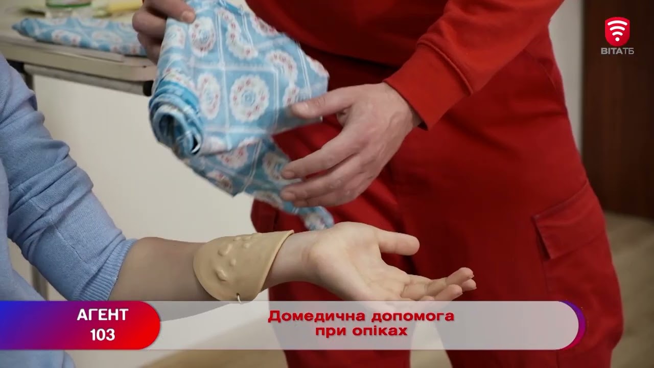 Домедична допомога при опіках