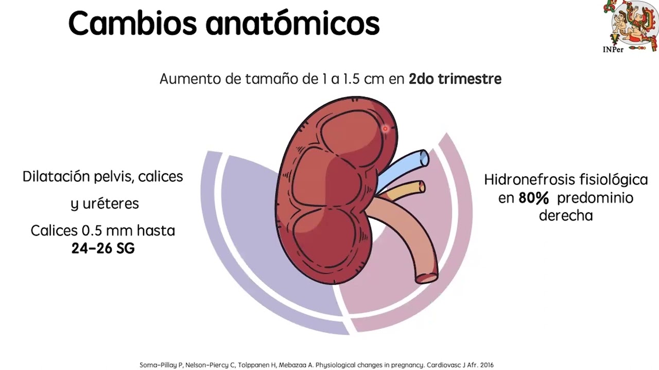 Embarazo y Enfermedad Renal Crónica Avanzada, Dra. Yoalli Danira Estévez Fuente