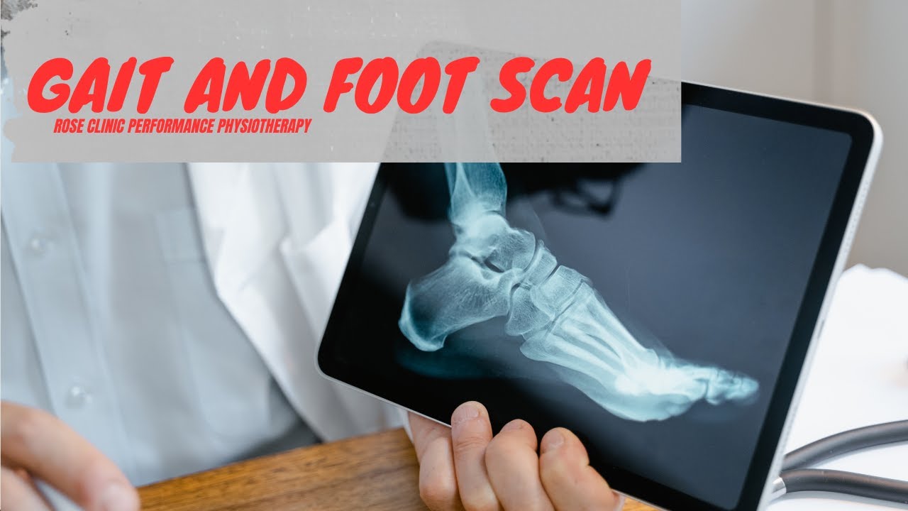 Foot Scan, Gait & Motion Analysis معاینه کف_پا با اسکن مدرن