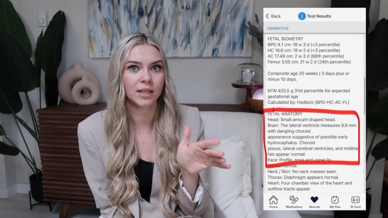 Our Diagnosis Day ~ Spina Bifida