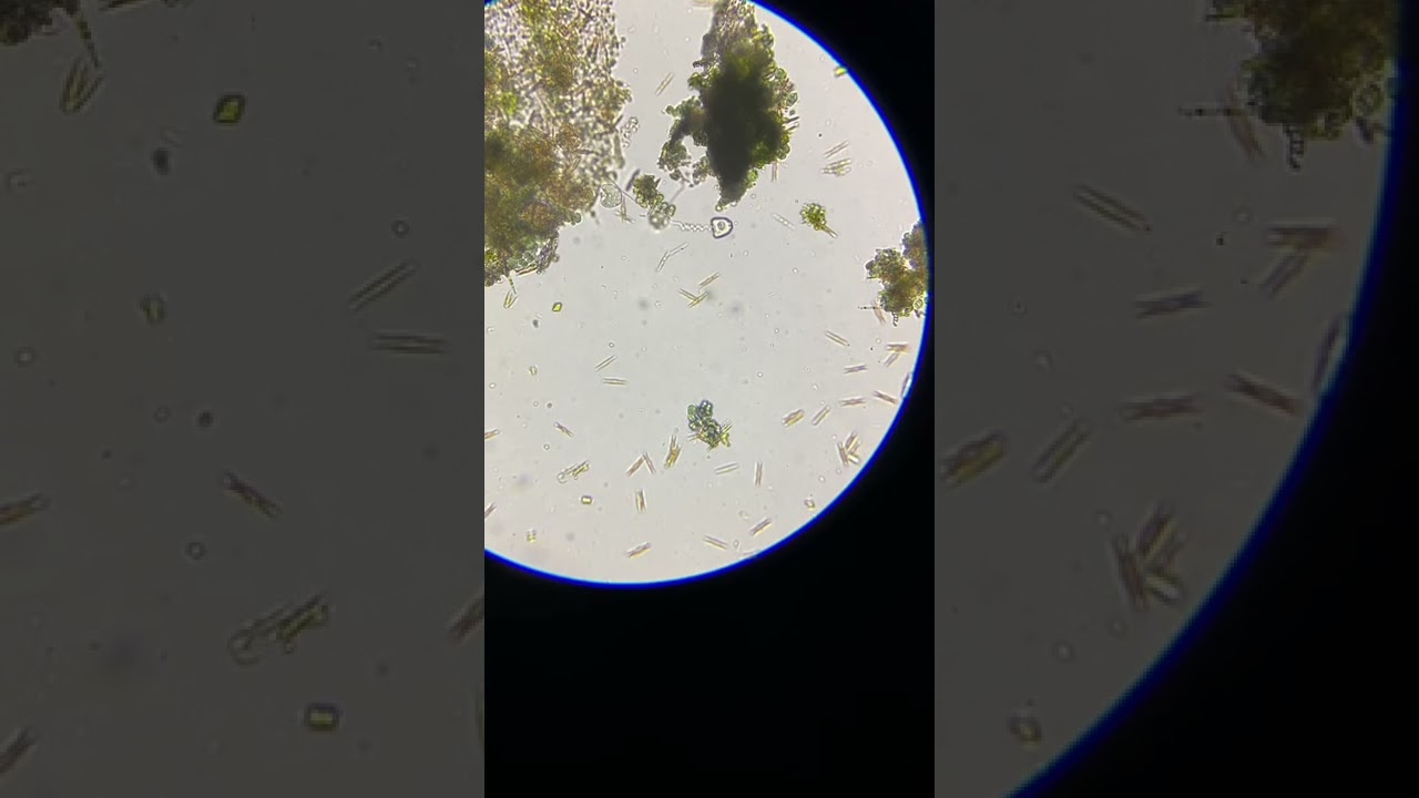 Vorticella under a microscope