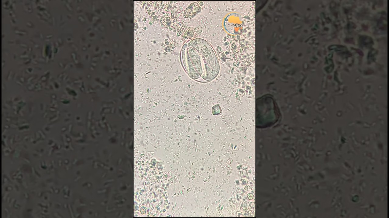Larve déjà présente dans l’œuf de Strongyloides stercoralis  
