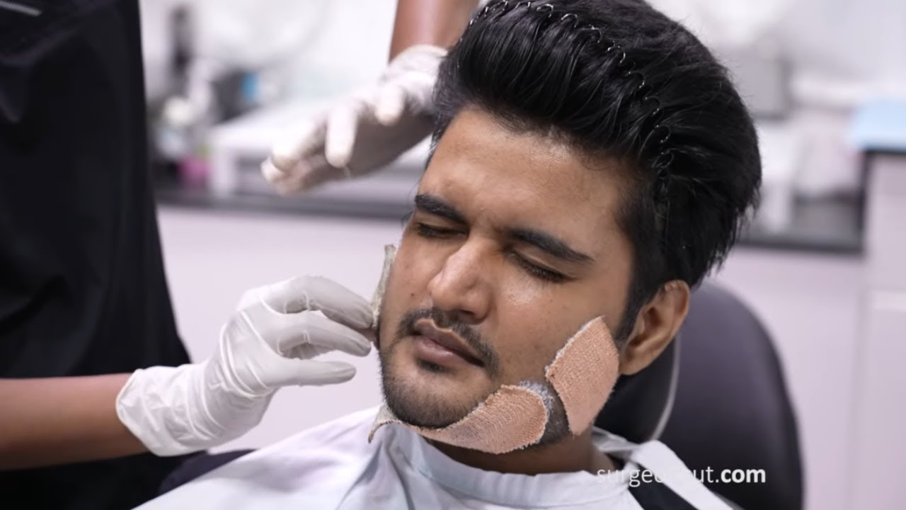 Face Transformation Surgery Procedure And Amazing Results | Complete Surgery Vlog
