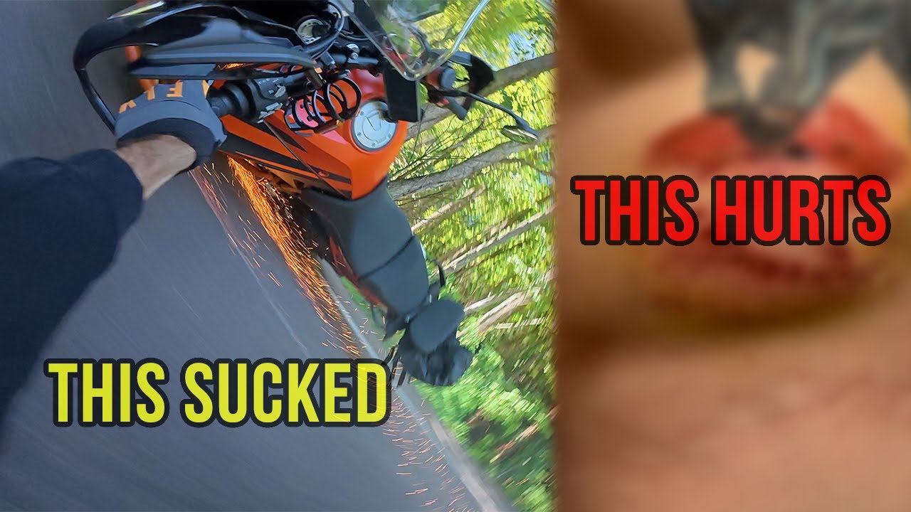 Crashed My Bike On The Tail Of The Dragon..