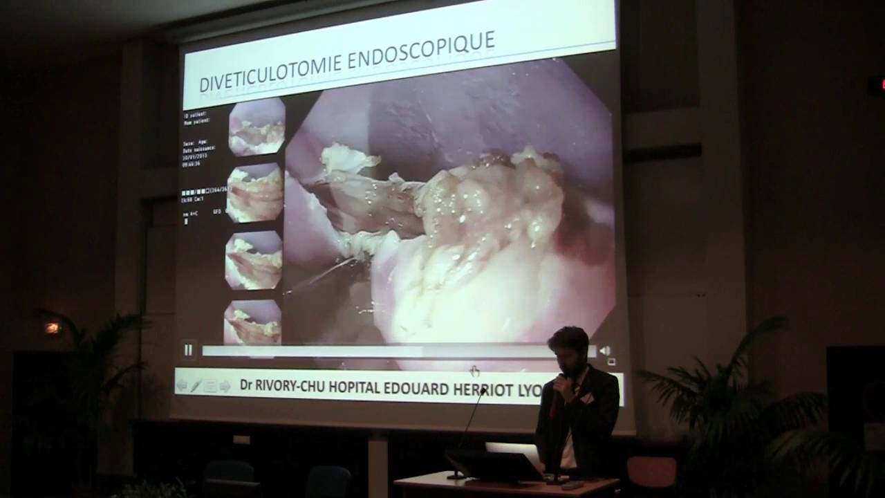 Endoscopie sous-muqueuse en 2016 - Drs. J&eacute;r&eacute;mie JACQUES et Romain LEGROS (Limoges, CHU)