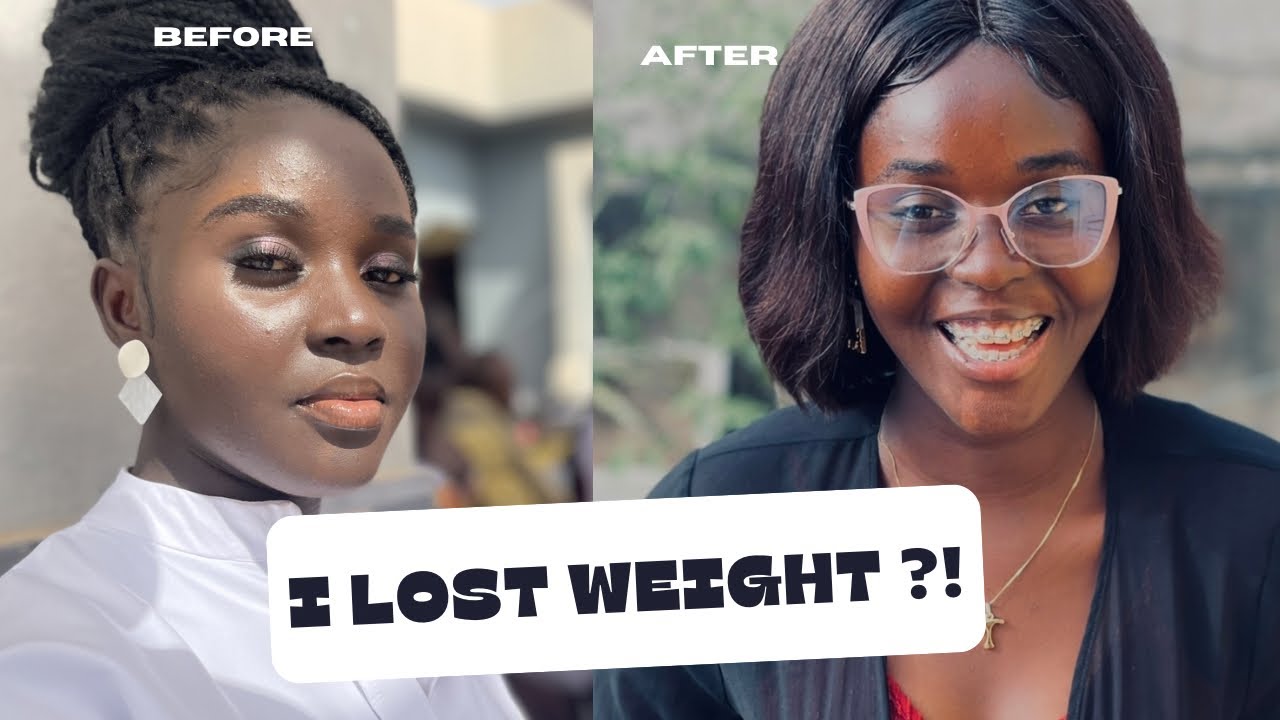 Did braces made me lose weight? My honest experience 