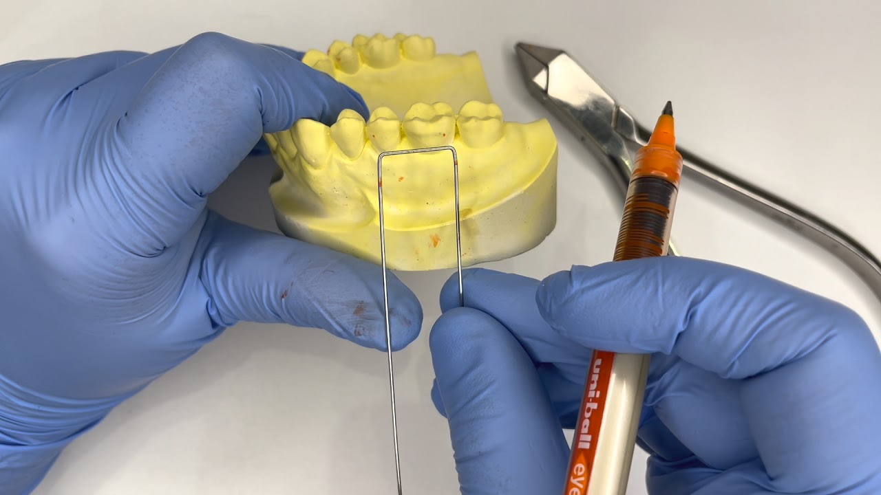 Double Adam's Clasp prepared by Dr. Maryam