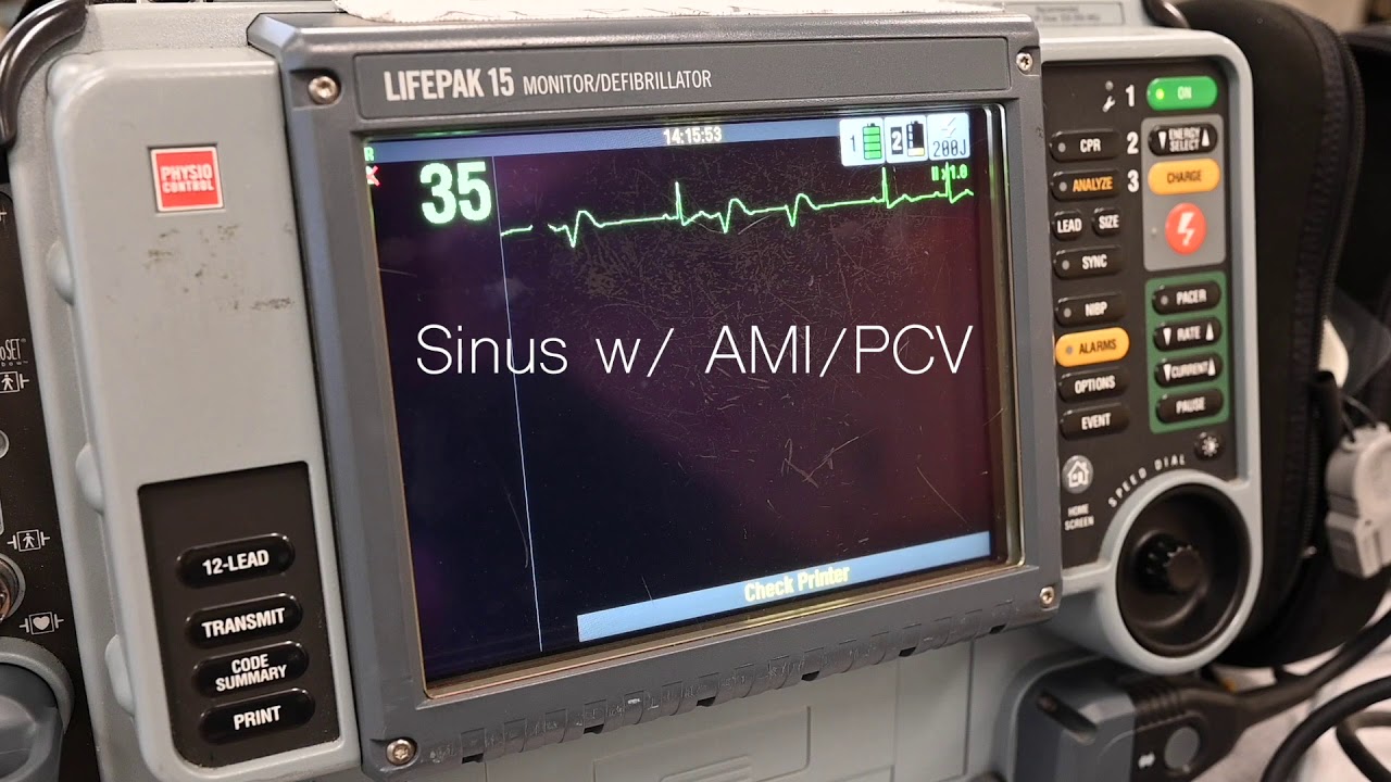 ECG/EKG Rhythm Generator Rhythms