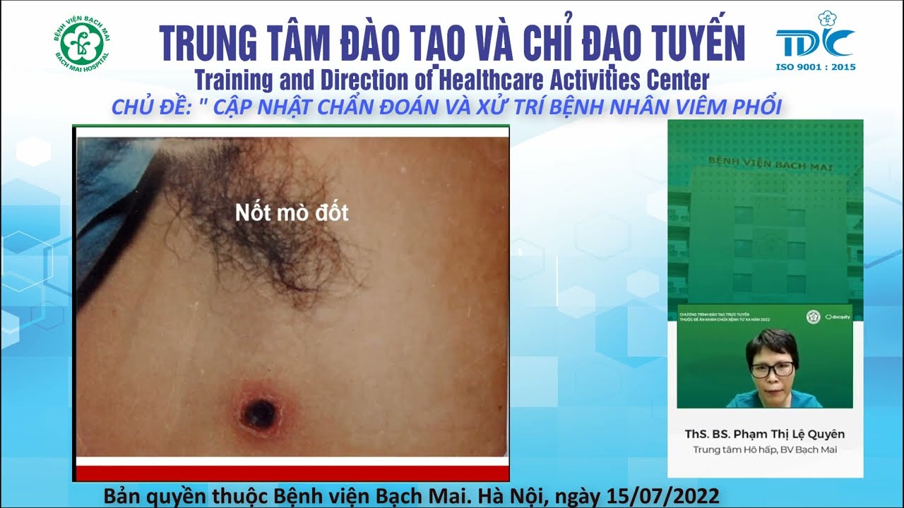 Cập nhật chẩn đoán và xử trí bệnh viêm phổi