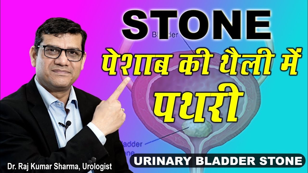 Urinary Bladder Stone / पेशाब की थैली में पथरी || Symptoms & Treatment || Dr. Raj Kumar Sharma