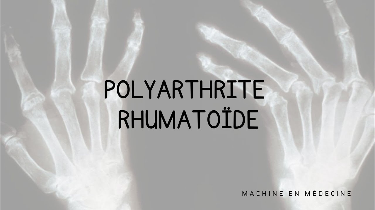 Polyarthrite Rhumatoïde (PR)