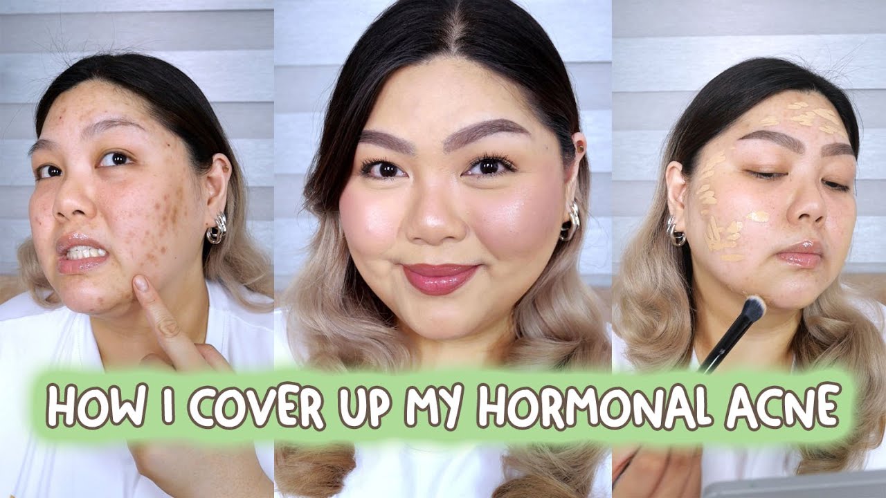 MY ACNE MAKEUP ROUTINE (HOW I COVER MY HORMONAL ACNE) | Bing Castro