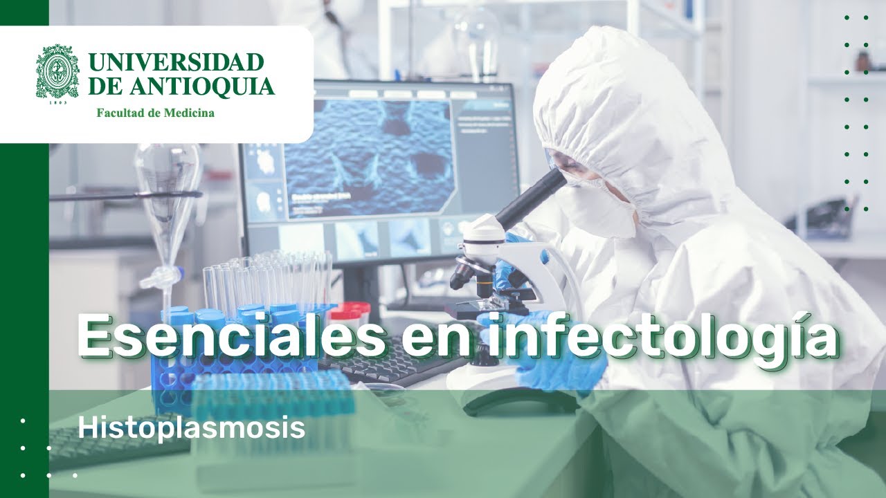 Histoplasmosis - Dra. Carolina Ochoa