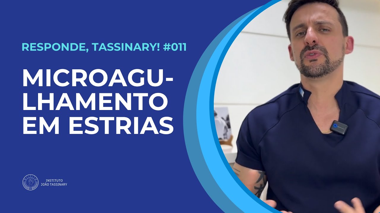 Microagulhamento em estrias? | Responde, Tassinary! #11
