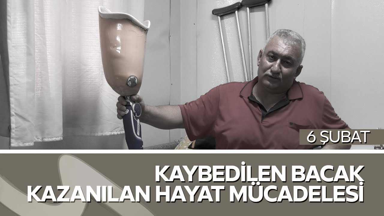 “Depremde Bacağını Kaybetti, Umudunu Kaybetmedi | Ejder Güzel’in Hayat Mücadelesi”