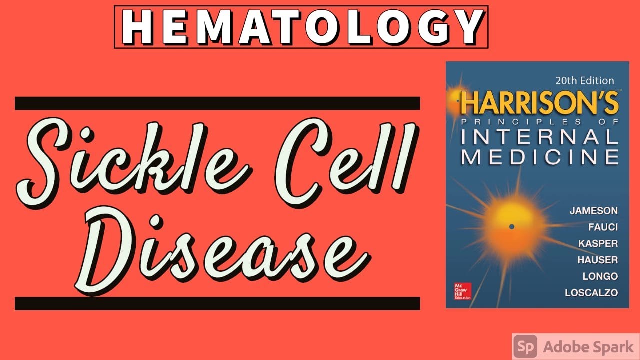 SICKLE CELL DISEASE | Clinical Features | Diagnosis | Treatment | Harrison