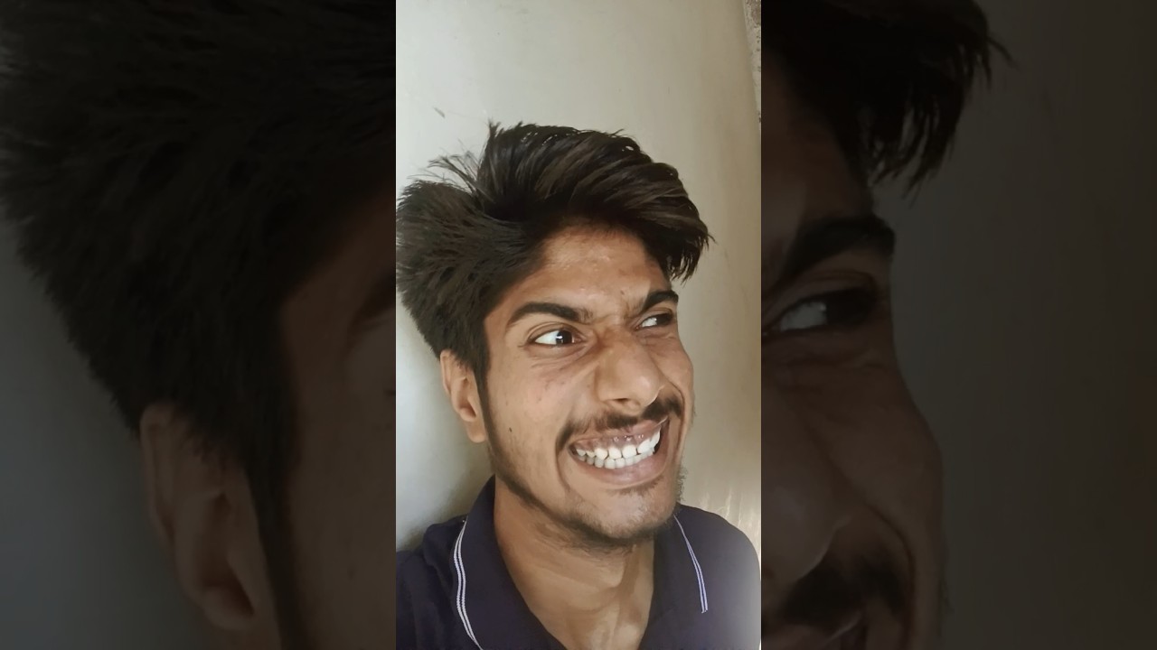 plastics surgery 🤣 #comedy #plasticsurgery #annabhai #shorts