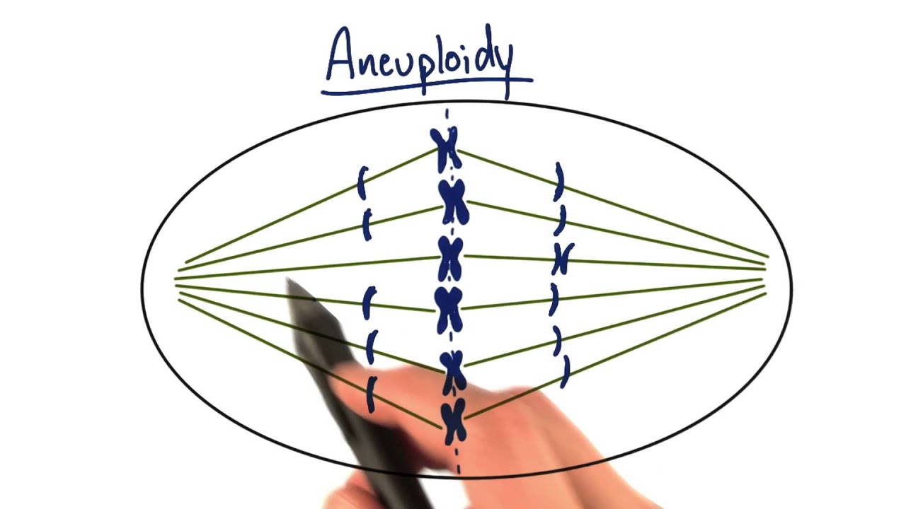 Aneuploidy - Tales from the Genome