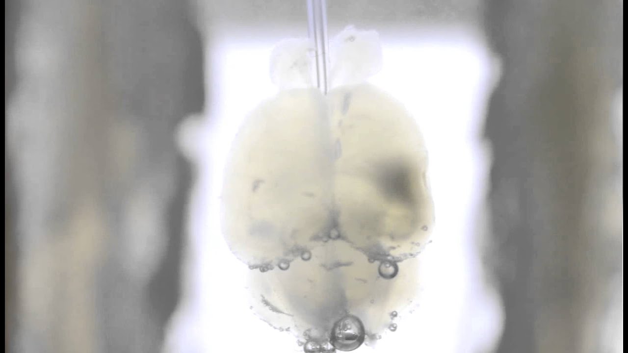 Clearing a mouse brain with the X-CLARITY&trade;