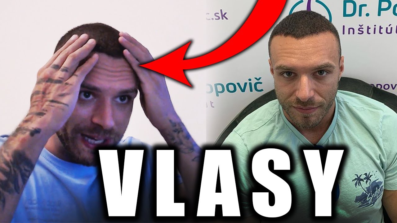 Restt - 4 mesiace po TRANSPLANT&Aacute;CII, Kedy ďal&scaron;ia transplant&aacute;cia?