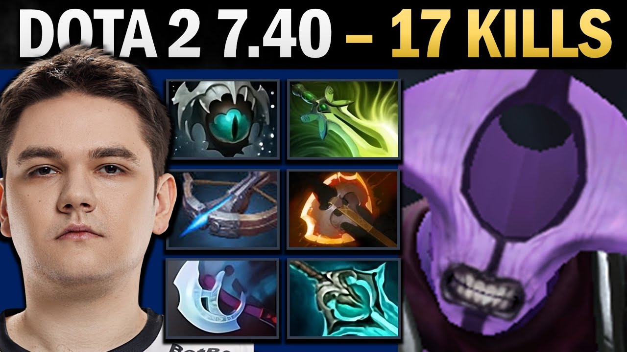 Faceless Void Pro Carry with 17 Kills and Battlefury - Gameplay Dota 2