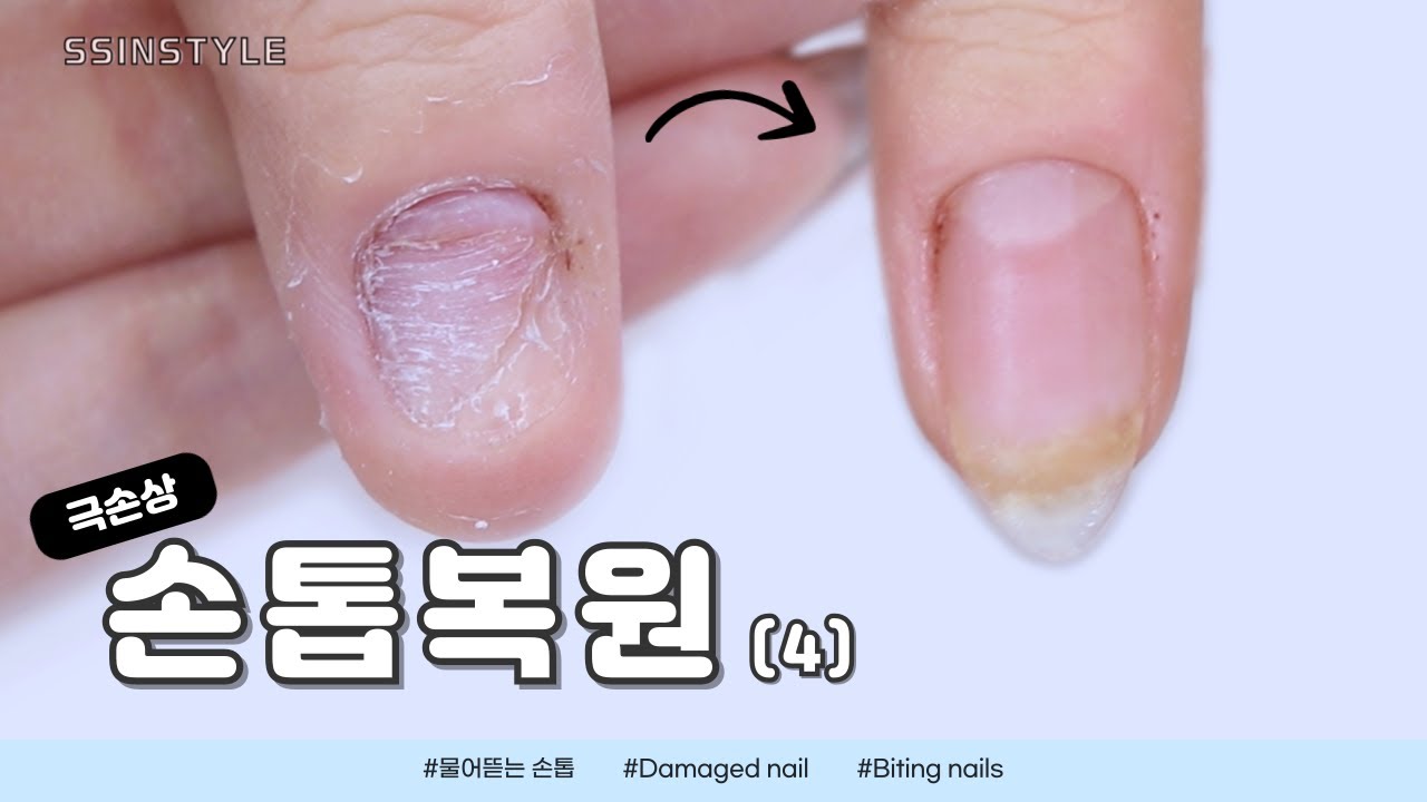 Eng sub)드디어!! 물어뜯는손톱 완전 회복한거같아요😆🎉🎆/협찬제품포함