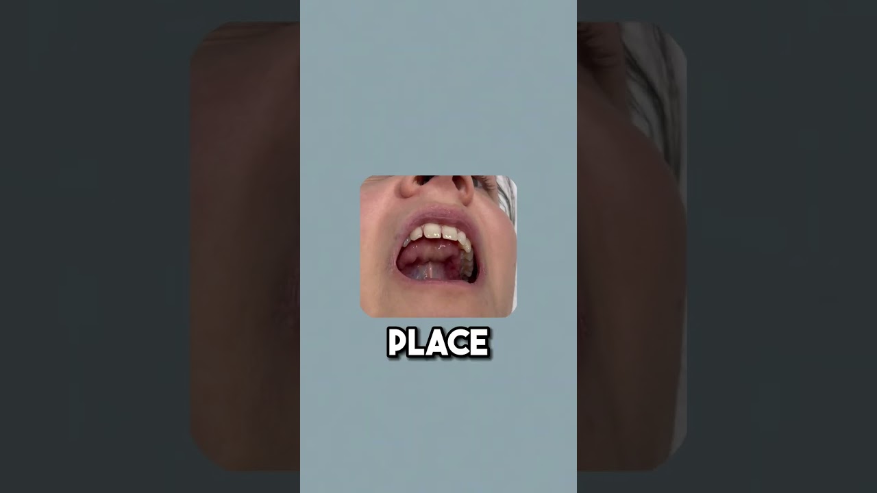 Mastering Tongue Posture: Improve Your Breathing Today