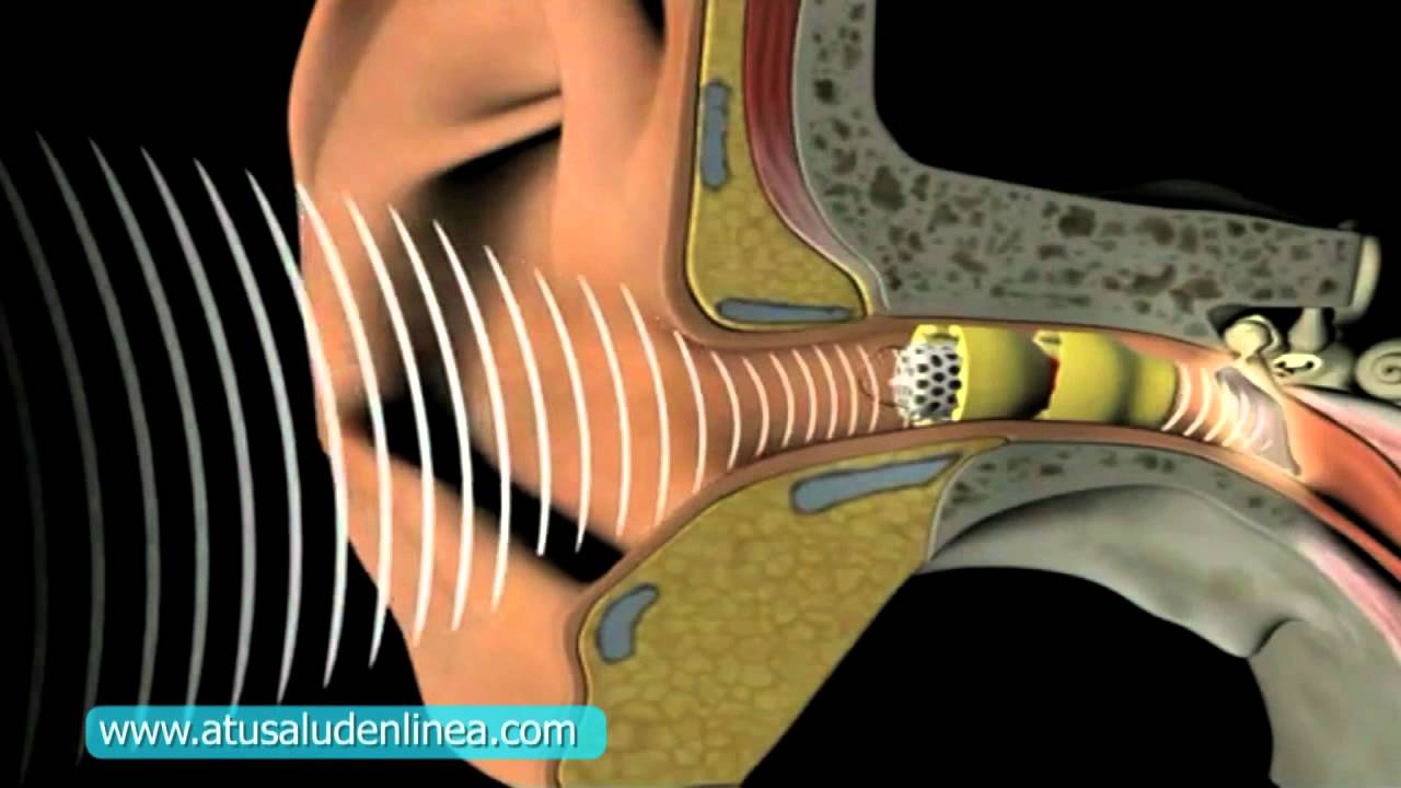 MICRO: Neurofeedback y autismo