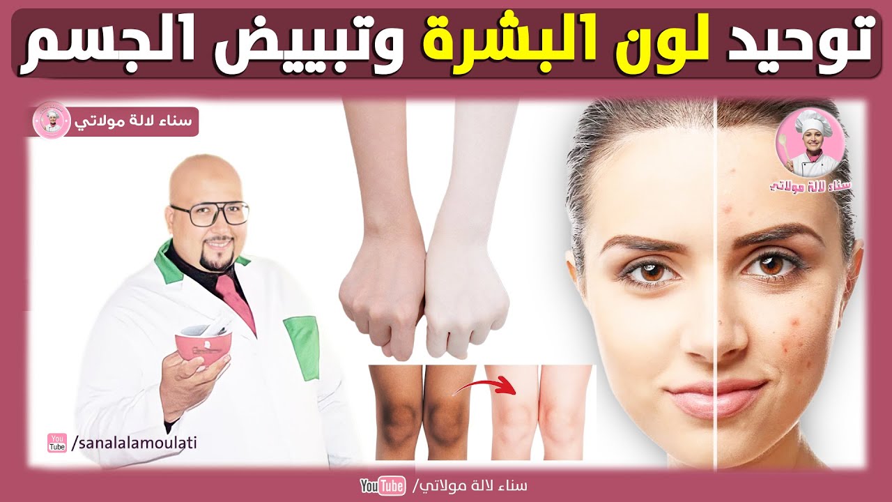 توحيد لون البشرة وتبييض الجسم وصفات الدكتور عماد ميزاب Dr imad Mizab