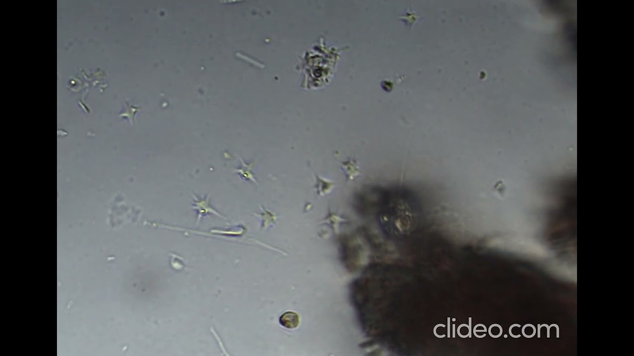 20240106 tiny amoeboids in floating form